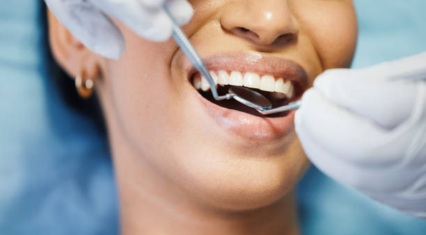 Best Emergency Wisdom Teeth Removal in Leisure Village East, NJ
