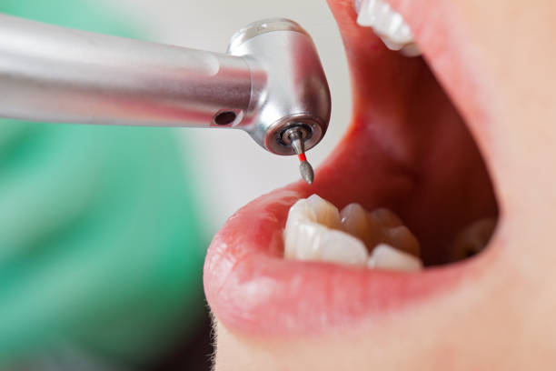 Best Emergency Dental Care for Broken or Chipped Teeth in Leisure Village East, NJ